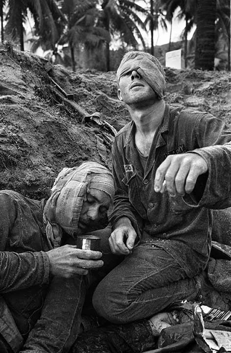 Medic Thomas Cole of Richmond, Virginia, looks up with his one unbandaged eye as he continues to treat wounded S.Sgt. Harrison Pell of Hazleton, Pennsylvania, during a firefight, January 30, 1966.
