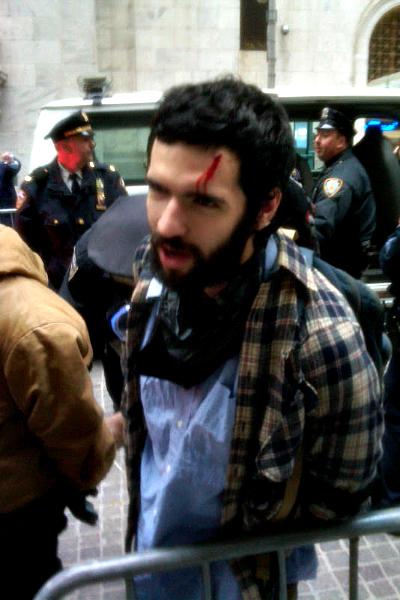 A protester bleeding from the head