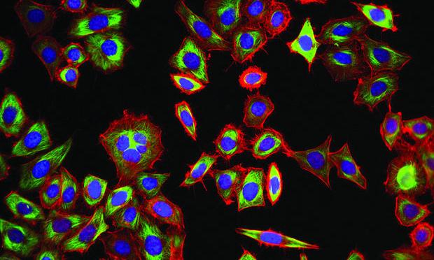 HeLa cells treated with a microtubule stabilizing drug, paclitaxel. Stained for DNA (blue), tubulin (green) and actin (red). HeLa cells treated with a microtubule stabilizing drug, paclitaxel. Stained for DNA (blue), tubulin (green) and actin (red).