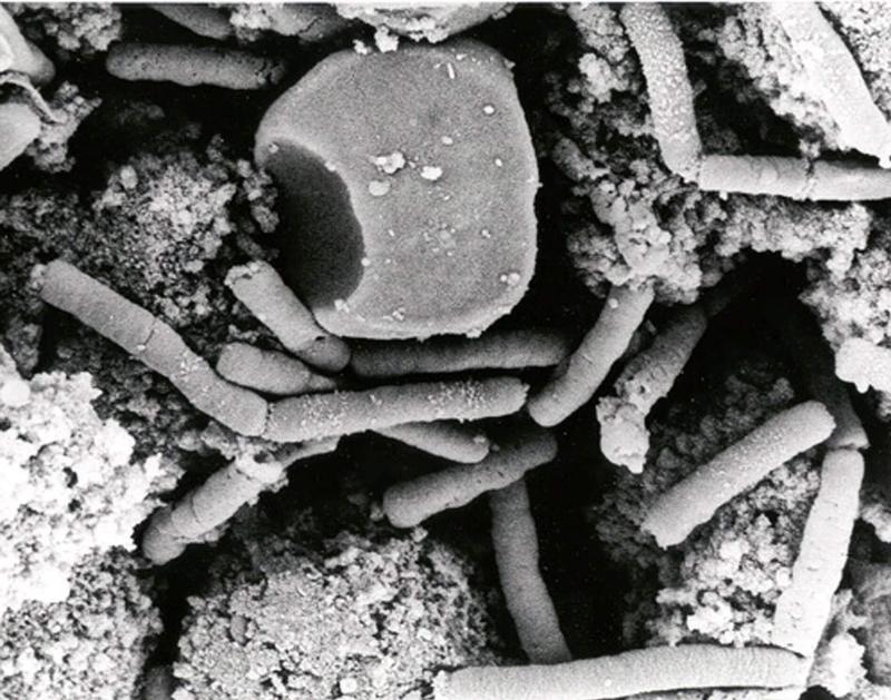 Bacillus anthracis vegetative cells and spores, which cause the infectious disease Anthrax, in a monkey spleen in an undated photomicrograph from the U.S Department of Defense.