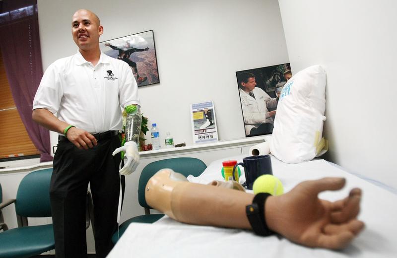 Retired U.S. Army Sergeant Juan Arredondo, a veteran of the war in Iraq, wears the world's first bionic hand with independently moving fingers July 23, 2007 in New York City.