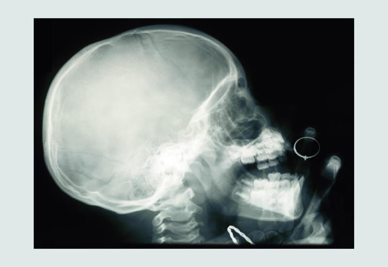 Skull and Hand, circa 1900.