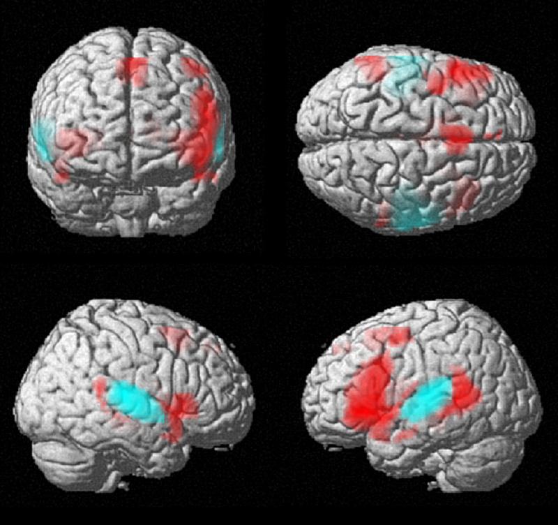 A map of left and right brain networks used in the PlOS ONE study. Green lines show common relationships across subjects.