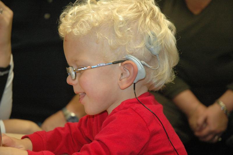 Cochlear implant