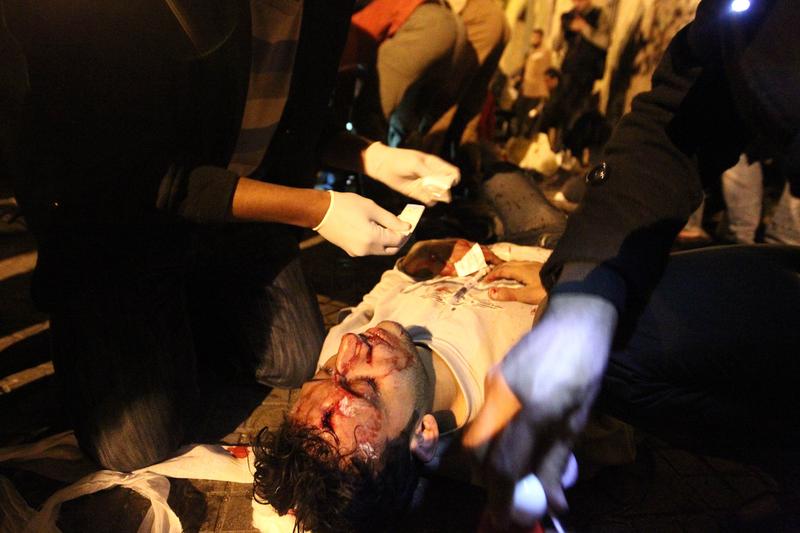 A wounded Egyptian anti-government demonstrator receives treatment on a pavement at Cairo's Tahrir Square on February 2, 2011.