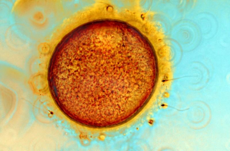 Human ovum (egg) and sperm.