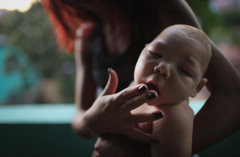 A woman holds her 5-month-old nephew, who has microcephaly, in Recife, Brazil.