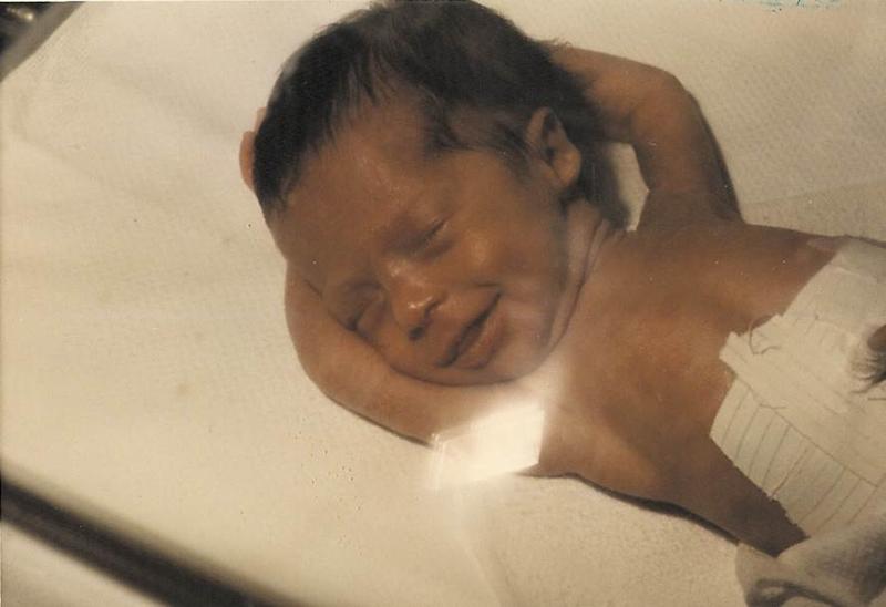 Susannah Ludwig was born with an incurable genetic defect.