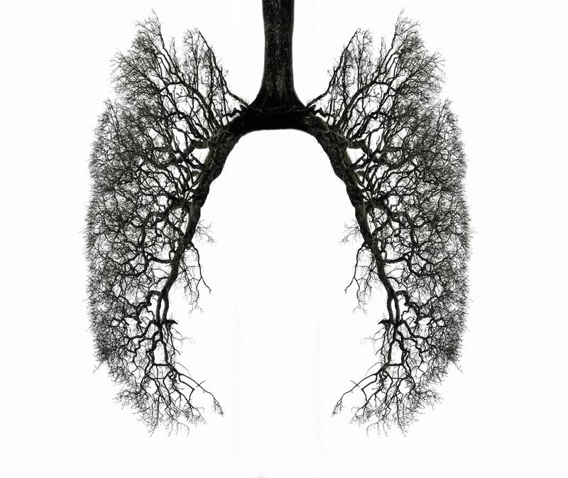 The new medicine for Cystic Fibrosis costs hundreds of thousands of dollars