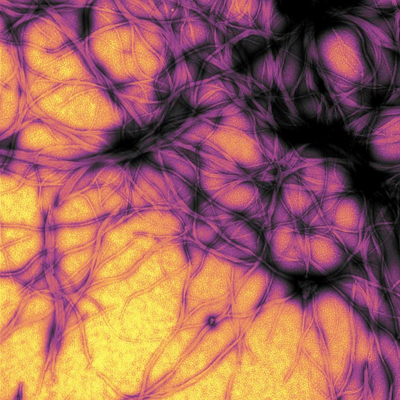 Prion Protein Fibrils